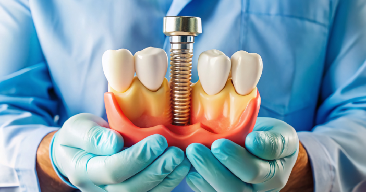 Bone graft model with gum and teeth with Bone Grafting in West Linn, OR